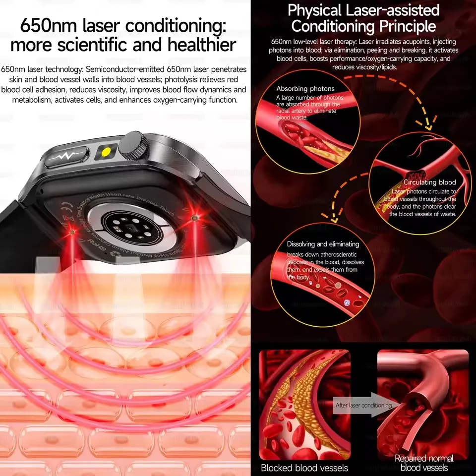 Smart Watch w/Laser Therapy - Image 2